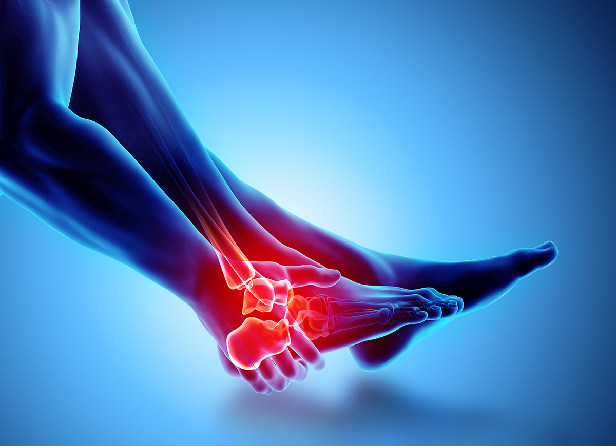 El tratamiento en el esguince de tobillo